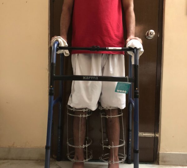 Height Increase Info